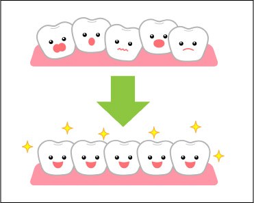 歯が移動するメカニズム